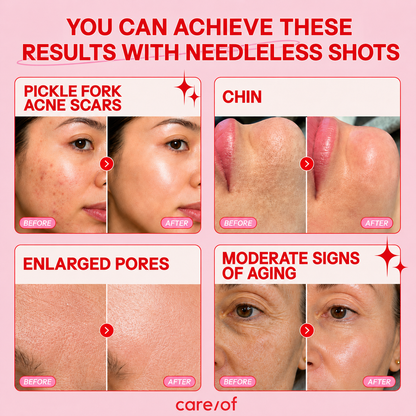 Bio-Microneedling Shots — Deep + Soft Set